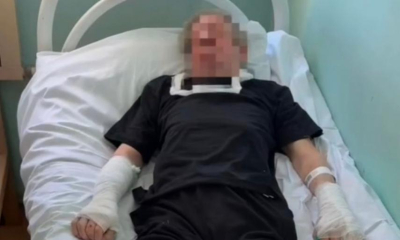 Стало известно состояние пенсионера, на которого напали собаки под Казанью